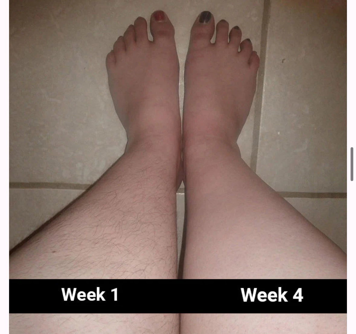 GlowSmooth Pro| Permanente Haarentfernung in nur 4 Wochen