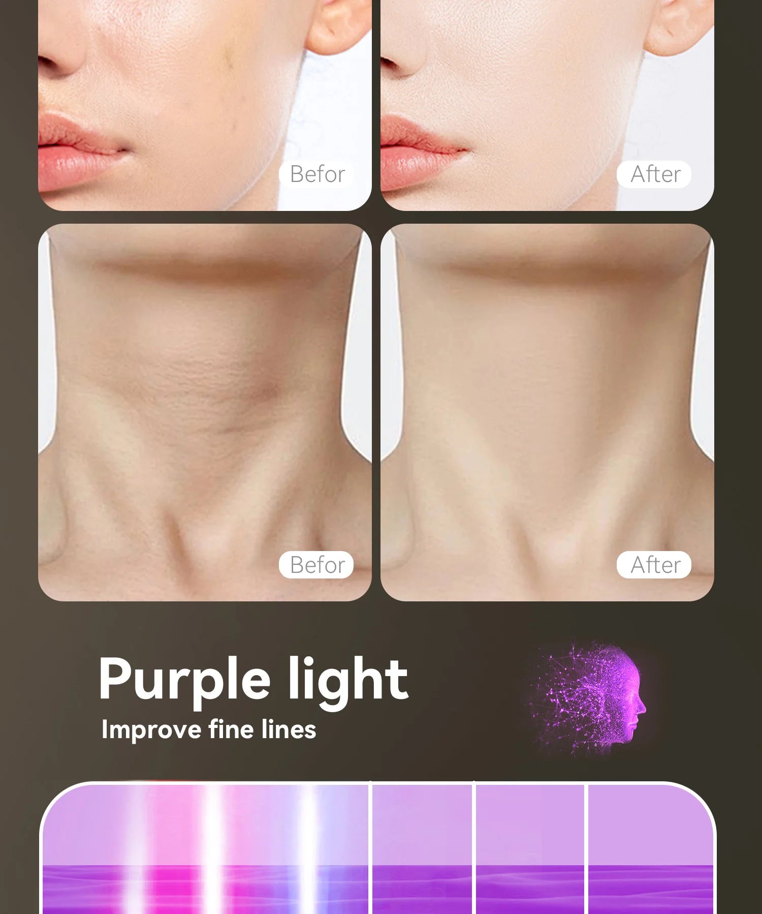 CelestiSkin IR Elite – Premium Rotlicht-Beauty-Maske