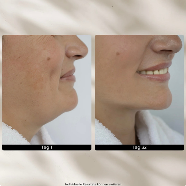 EMS GlowLift Pro  | Beauty Tool with Light Therapy