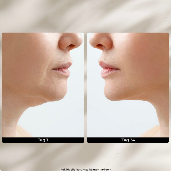 EMS GlowLift Pro  | Beauty Tool with Light Therapy