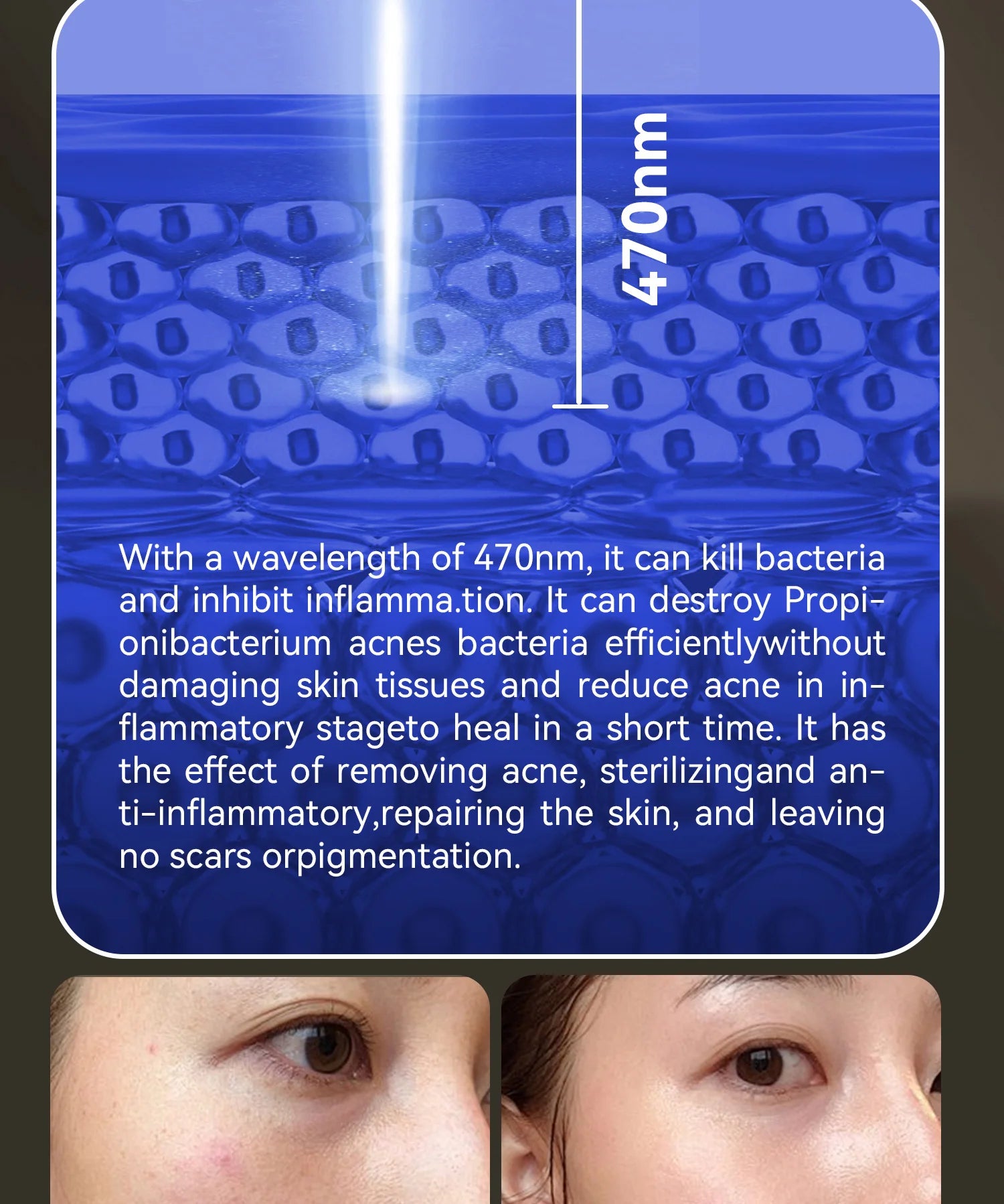 CelestiSkin IR Elite – Premium Rotlicht-Beauty-Maske